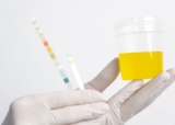 What Are Hyaline Casts In Urine?